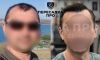 4 степень облысения, пересажено 5000 графтов, результат через 12 месяцев