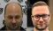 6–7 степень облысения, пересажено 8000 графтов, результат через 9 месяцев